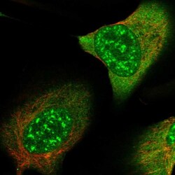 TATDN1 Antibody, Novus Biologicals:Antibodies:Primary Antibodies